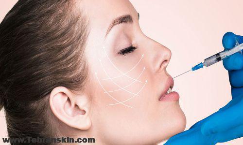 تزریق چربی در تهران