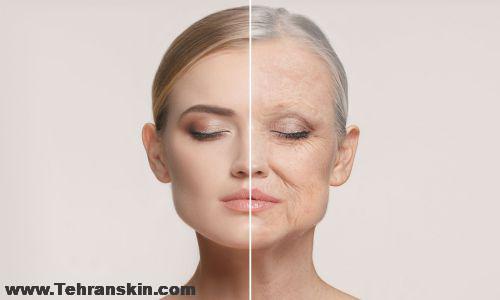 جوان سازی پوست در بابل