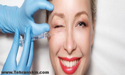 تزریق ژل در سنندج