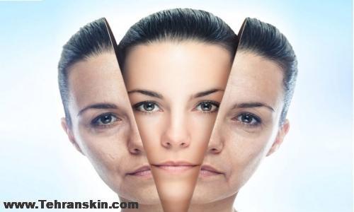 تفاوتهای بوتاکس و فیلر