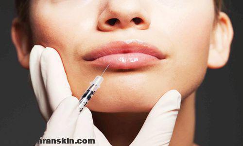 تزریق ژل در شهریار