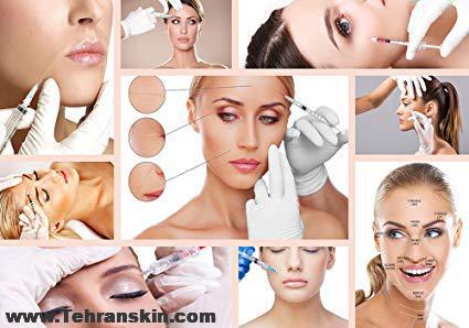 تفاوت فیلر با ژل