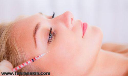 تزریق بوتاکس در شهریار