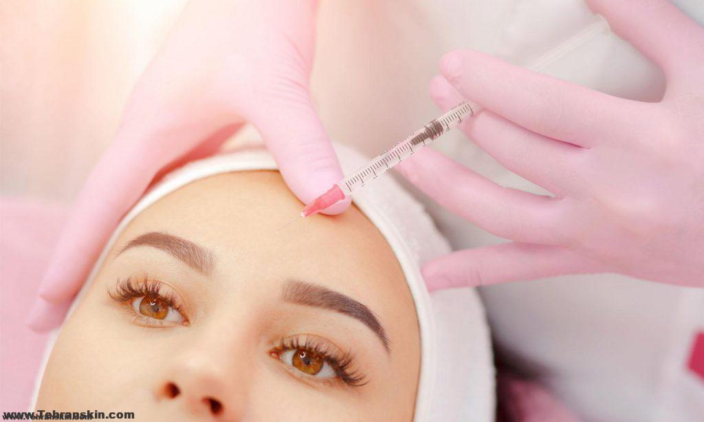 بهترین دکتر تزریق بوتاکس در تهران