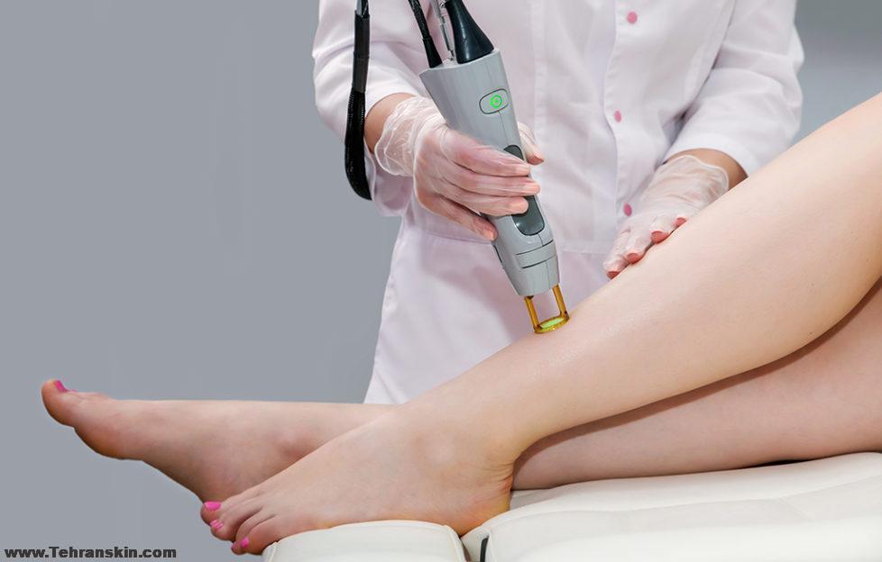 لیزر موهای زائد در آبادان