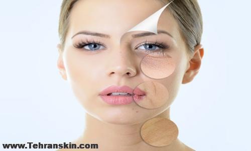 جوانسازی پوست در ملارد