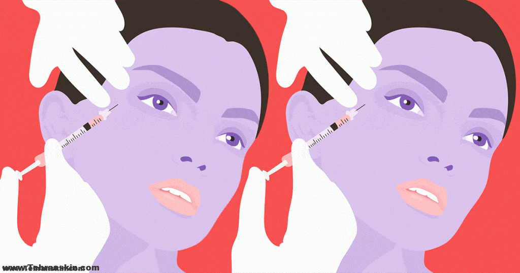 تخفیف بوتاکس در تهران