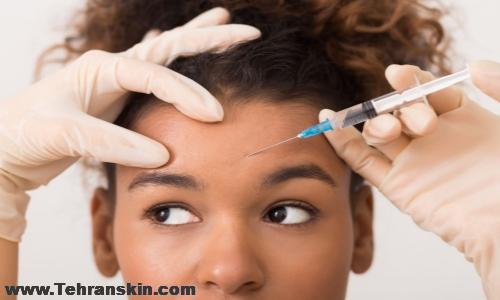 بوتاکس در اصفهان