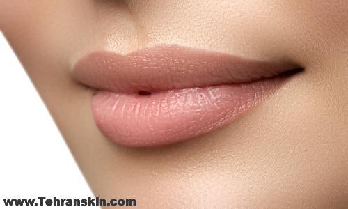تزریق ژل لب در سمنان