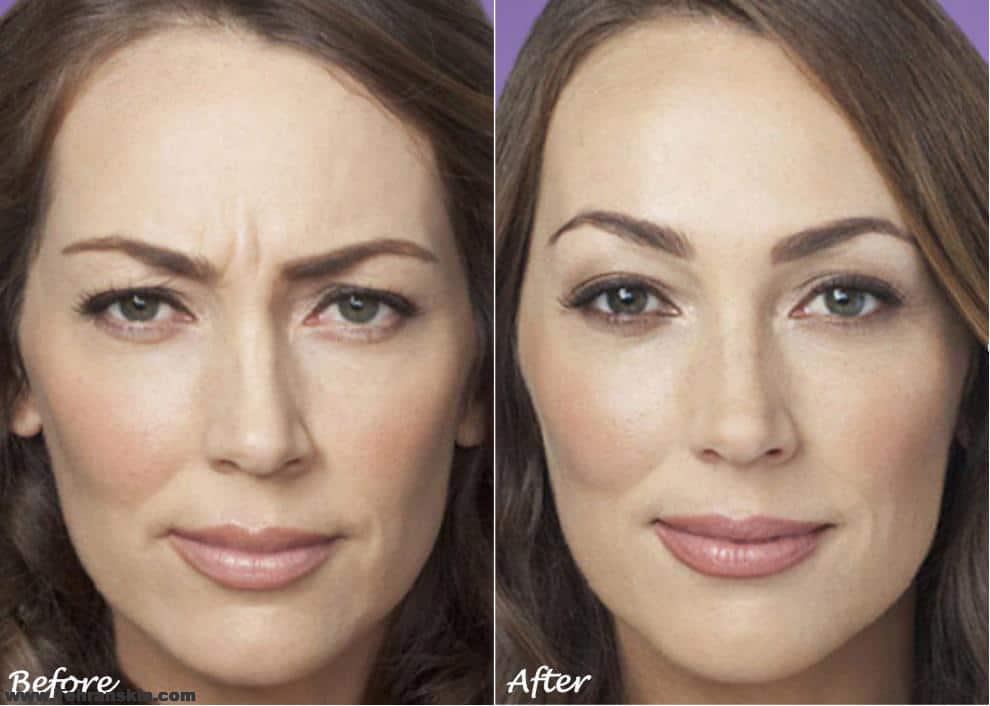 مرکز بوتاکس تهران