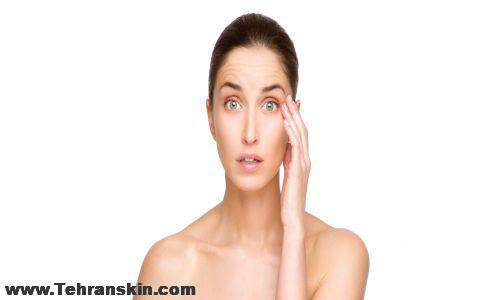 جراحی پلک با لیزر