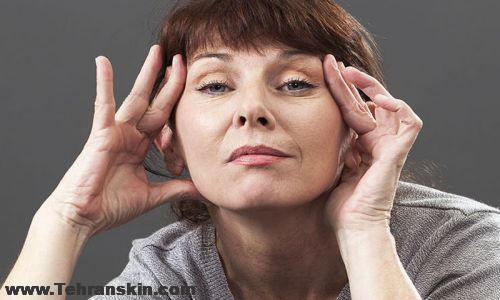 جراحی پلک ارزان