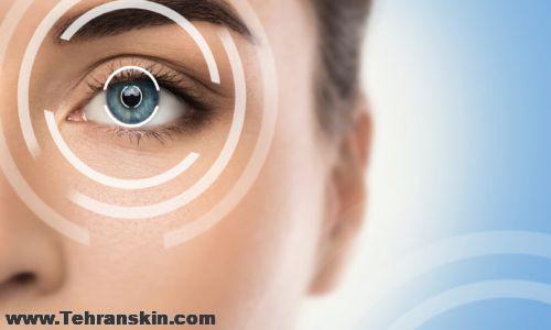 جراحی افتادگی پلک