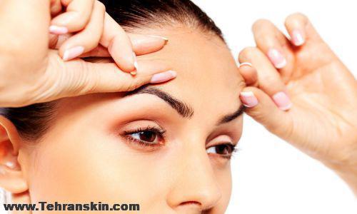 نت برگ بلفاروپلاستی