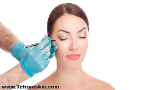 بهترین روش لیفت پلک