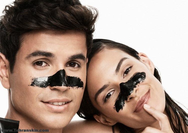 درمان سریع جوش سر سیاه