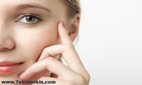 بلفاروپلاستی پلک