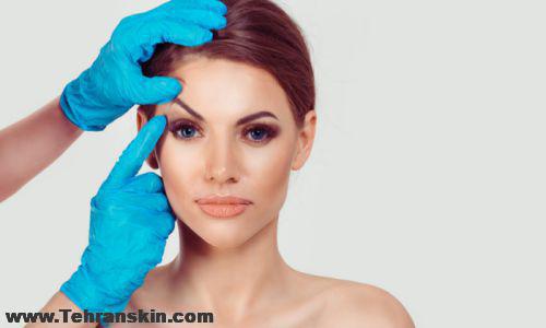 عوارض جراحی پلک بالا
