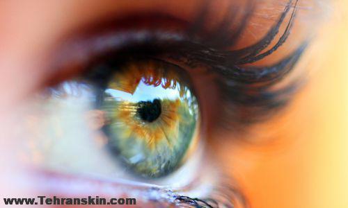 هزینه جراحی افتادگی پلک