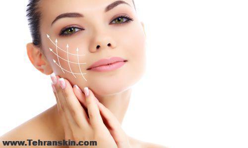 قیمت بوتاکس کل صورت