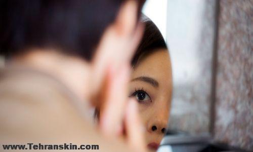 درمان افتادگی پلک