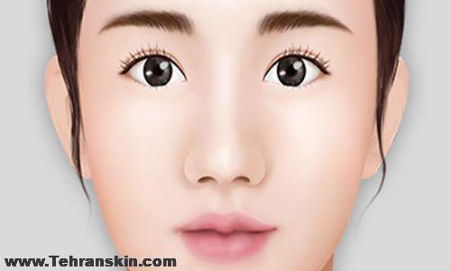 هزینه عمل بینی گوشتی