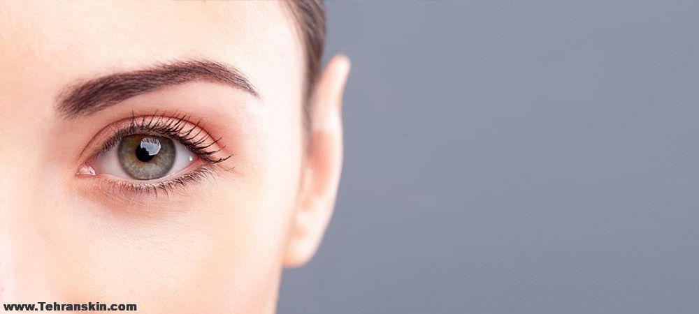 جراحی پلک