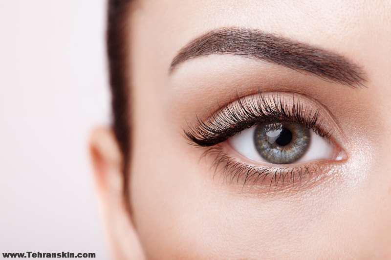 از بین بردن ورم بعد از عمل پلک