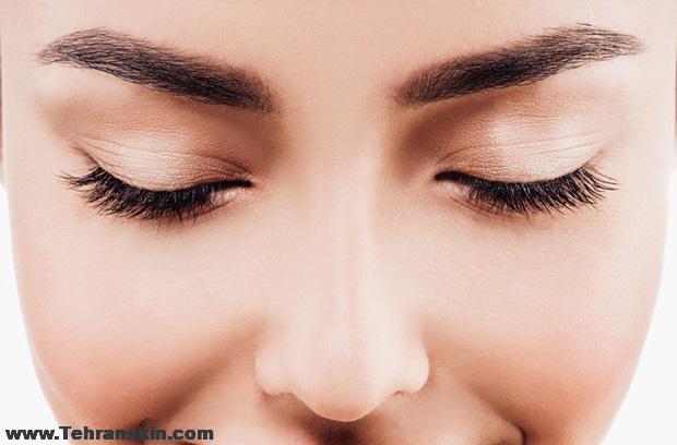 جراحی رینوپلاستی