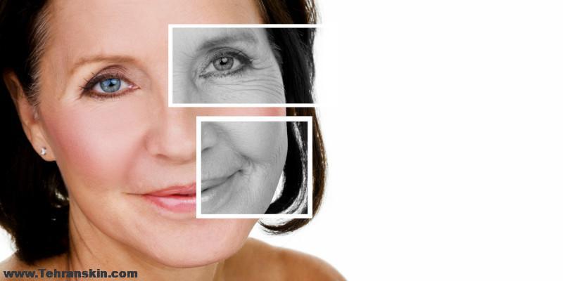 بهترین روش جوانسازی پوست
