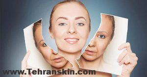 تجربه مزوتراپی صورت در بهترین مرکز مزوتراپی تهران ، برکه mezoterapija lica 300x157 - تجربه مزوتراپی صورت در بهترین مرکز مزوتراپی تهران ، برکه