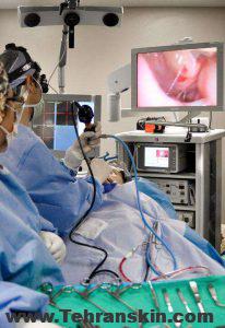 پروسه جراحی آندوسکوپی سینوس و بینی