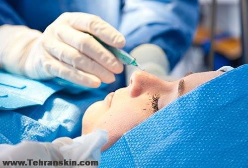 بلفاروپلاستی در مرکز برکه