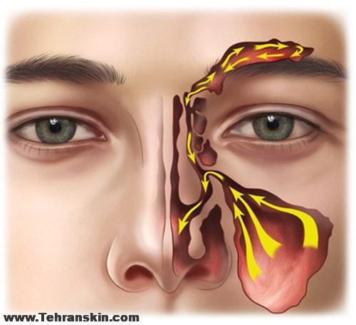 بهترین متخصص گوش و حلق و بینی