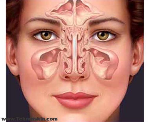 جراحی آندوسکوپی سینوس و بینی