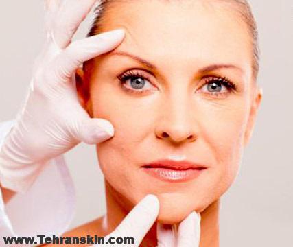 جوانسازی پوست در گرگان بکمک جراحی صورت