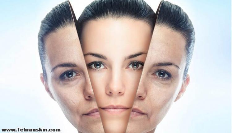 بهترین روش های جوانسازی صورت
