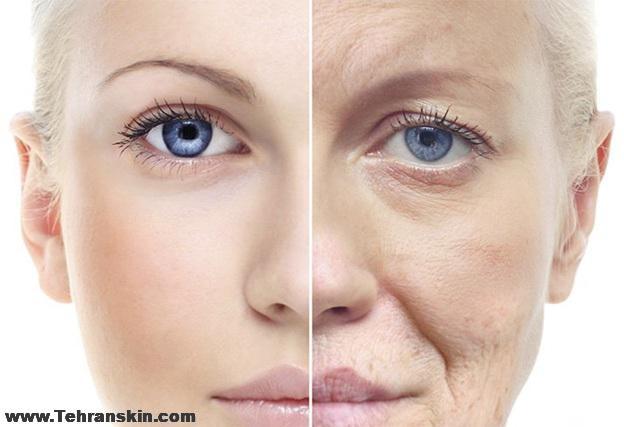 جوانسازی صورت با لیزر در تبریز