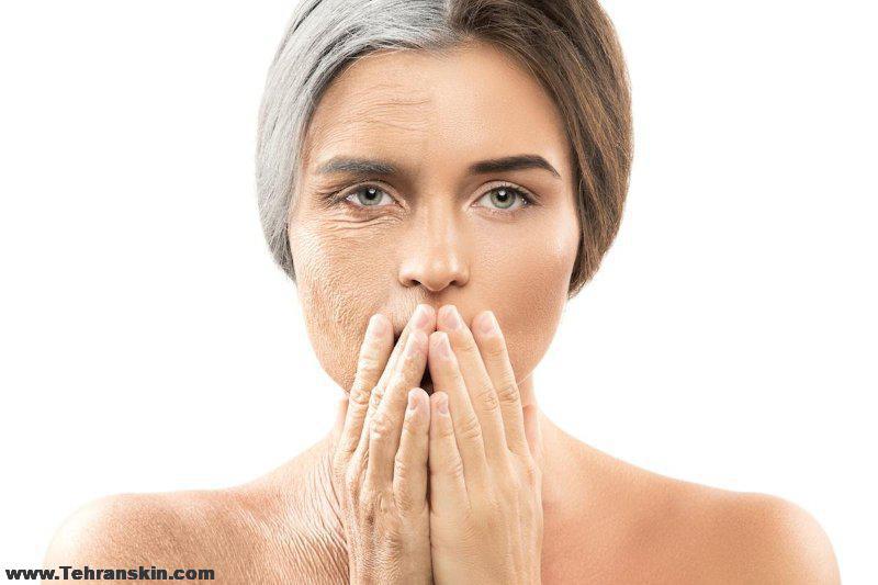 جوانسازی صورت در قم