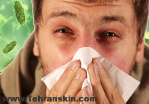 حساسیت و آلرژی و تاثیر آن در گودی زیر چشم