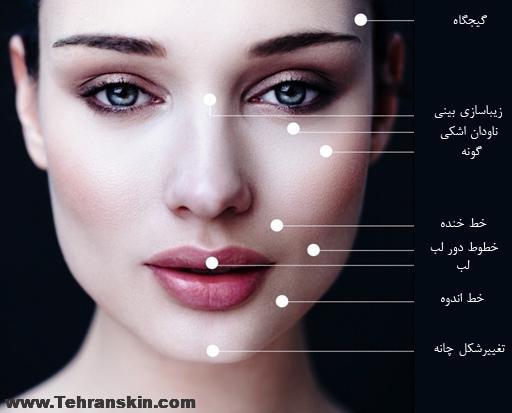 نواحی مختلف تزریق فیلر در گرگان
