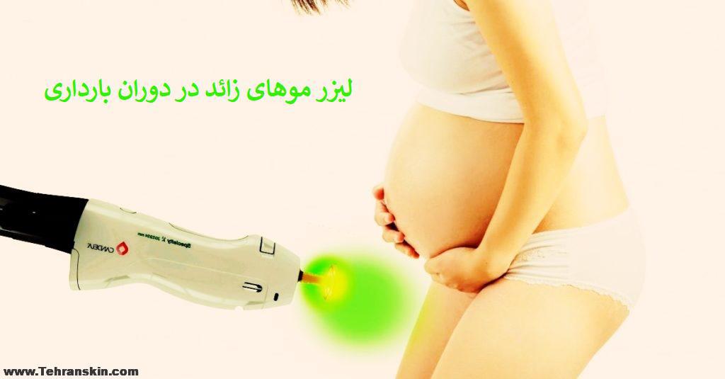 ایا لیزر برای زن باردار خطرناک است