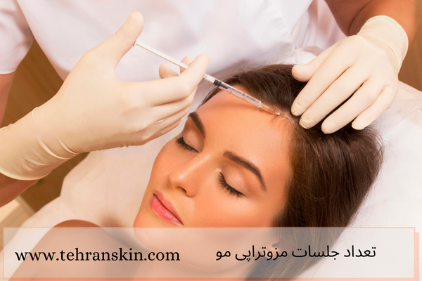 تعداد جلسات مزوتراپی مو