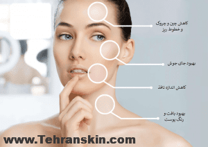 جوانسازی و آبرسانی پوست با تزریق مزوتراپی در بهترین مرکز مزوتراپی تهران Mesotherapy 1 300x212 - جوانسازی و آبرسانی پوست با تزریق مزوتراپی در بهترین مرکز مزوتراپی تهران