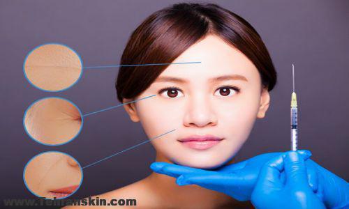 مزوتراپی اسکار صورت