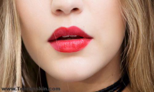 بهترین برند ژل لب و مقایسه قیمت های فیلر لب 150 - بهترین برند ژل لب و مقایسه قیمت های فیلر لب