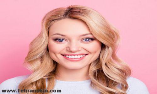 ایجاد چال گونه با نخ