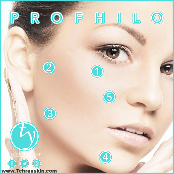پروفایلو صورت