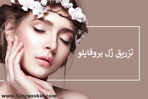 تزریق ژل پروفایلو در تهران