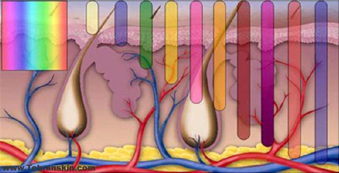 دستگاه لیزر الکس دایود خوبه؟ اگه نه، بهترین دستگاه لیزر کدومه؟